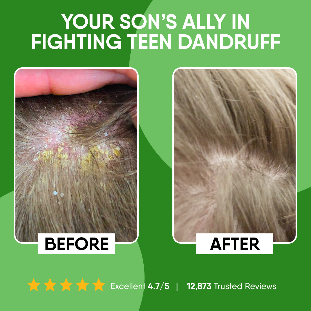 Scalp Repair Kit