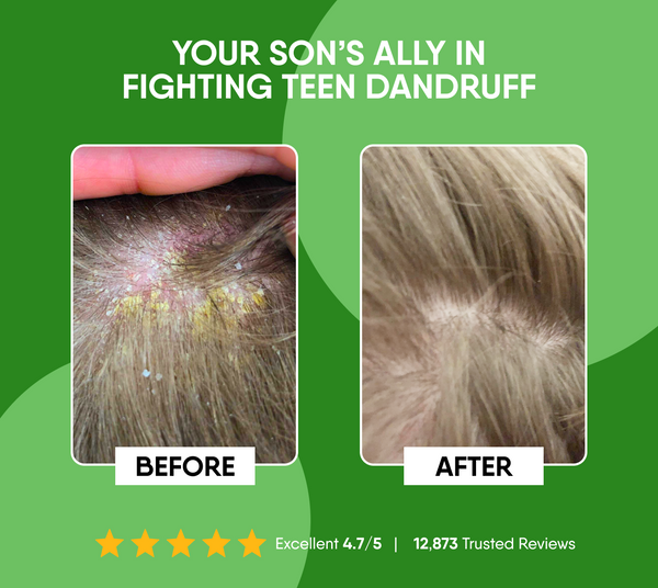 Manly Complete Hair Care Set