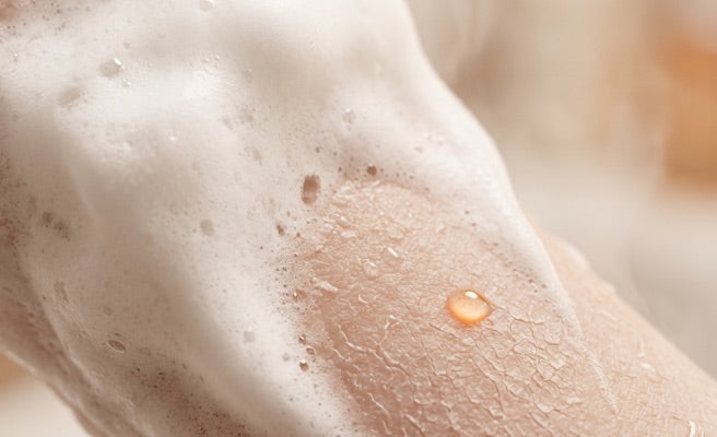 Close up of irritated teenage skin